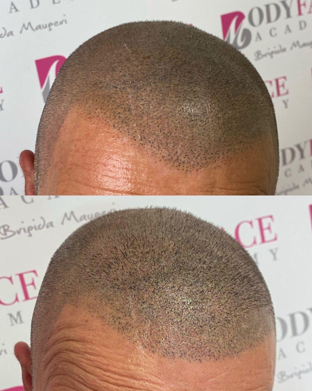 tricopigmentazione_naturale